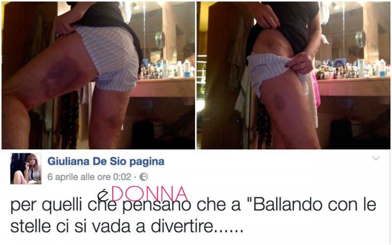 giuliana_de_sio_lividi